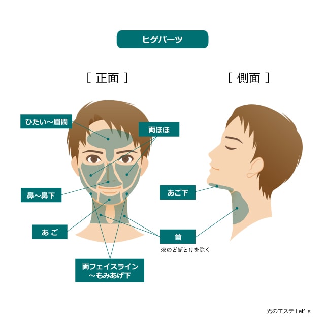 メンズ脱毛　ヒゲパーツ