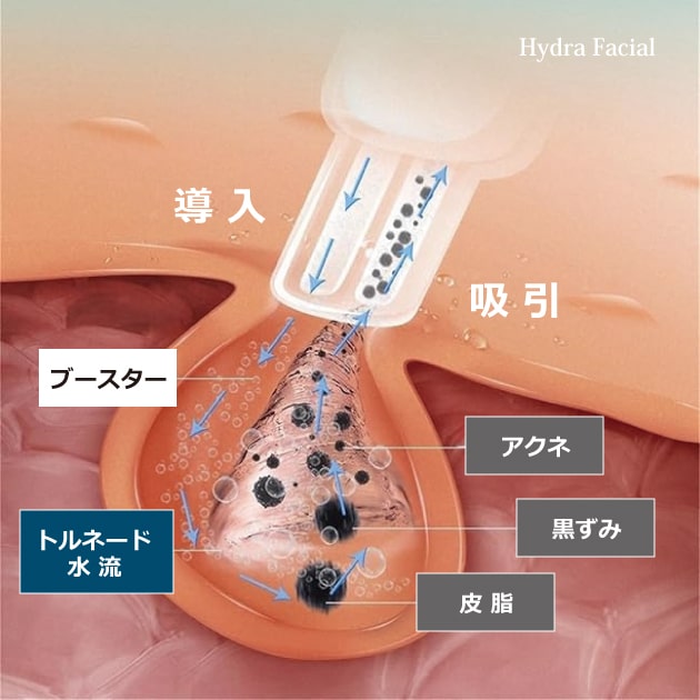 ハイドラフェイシャルの仕組み