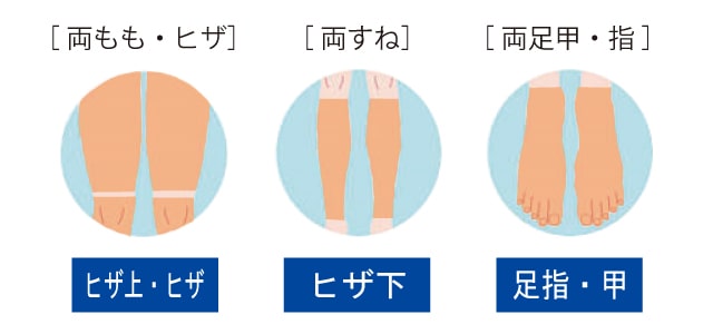 メンズ脱毛パーツ／足