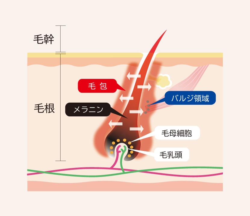 IPLハイブリット脱毛のメカニズム／ステップ③