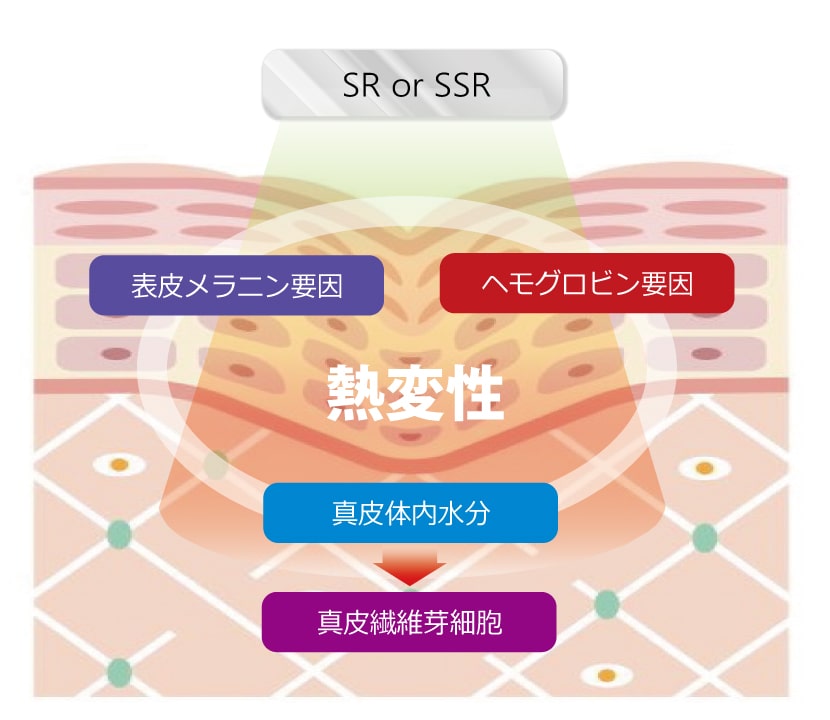 フォトIPLのメカニズム／ステップ②