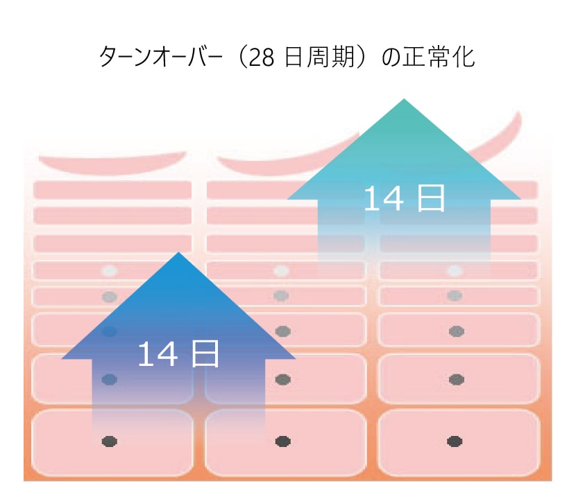 フォトIPLのメカニズム／ステップ④