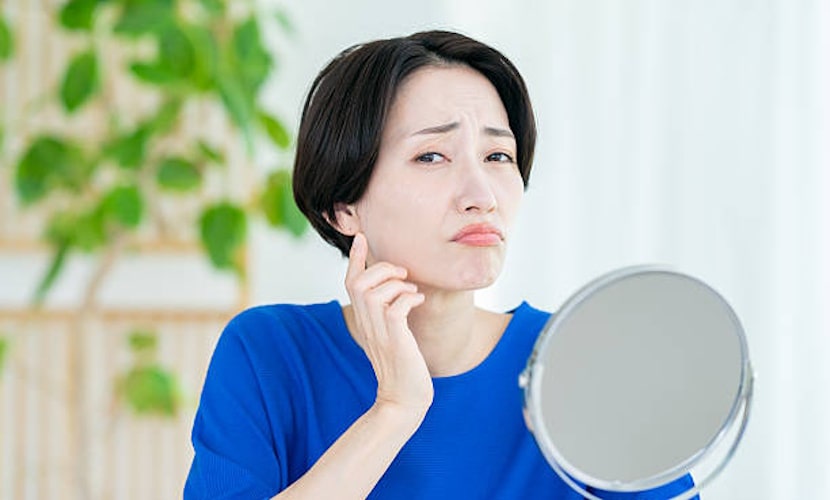 肌トラブル、鏡を見る女性