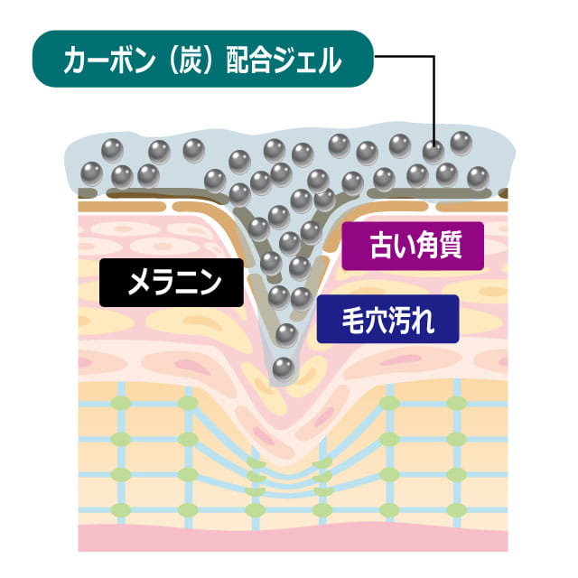 カーボンフェイシャルの手順