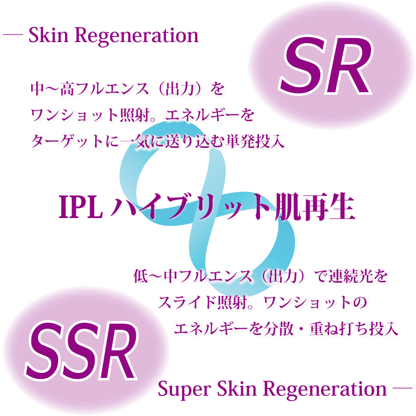 光のエステLet's,IPL,光線美容,光フェイシャル,SR,SSR